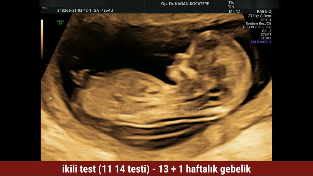 Sağlığın Genetik Anahtarı: Geleceğe Güvenle Adım Atın